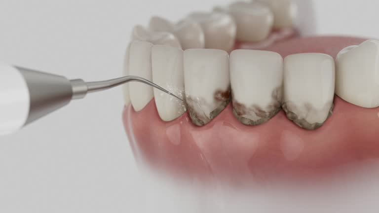 Reliable Dental Implants contractor in Wyoming County County, WV by Dentist Open Now